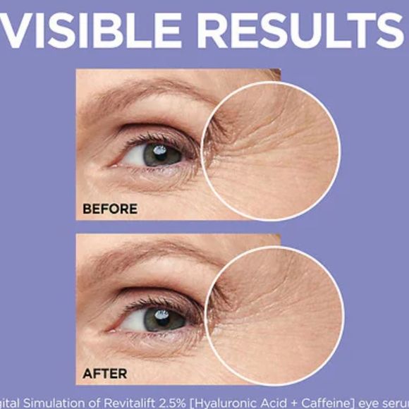 L'Oreal Paris Revitalift Derm Intensives Hyaluronic Acid and Caffeine Eye Serum - Picture 5 of 11